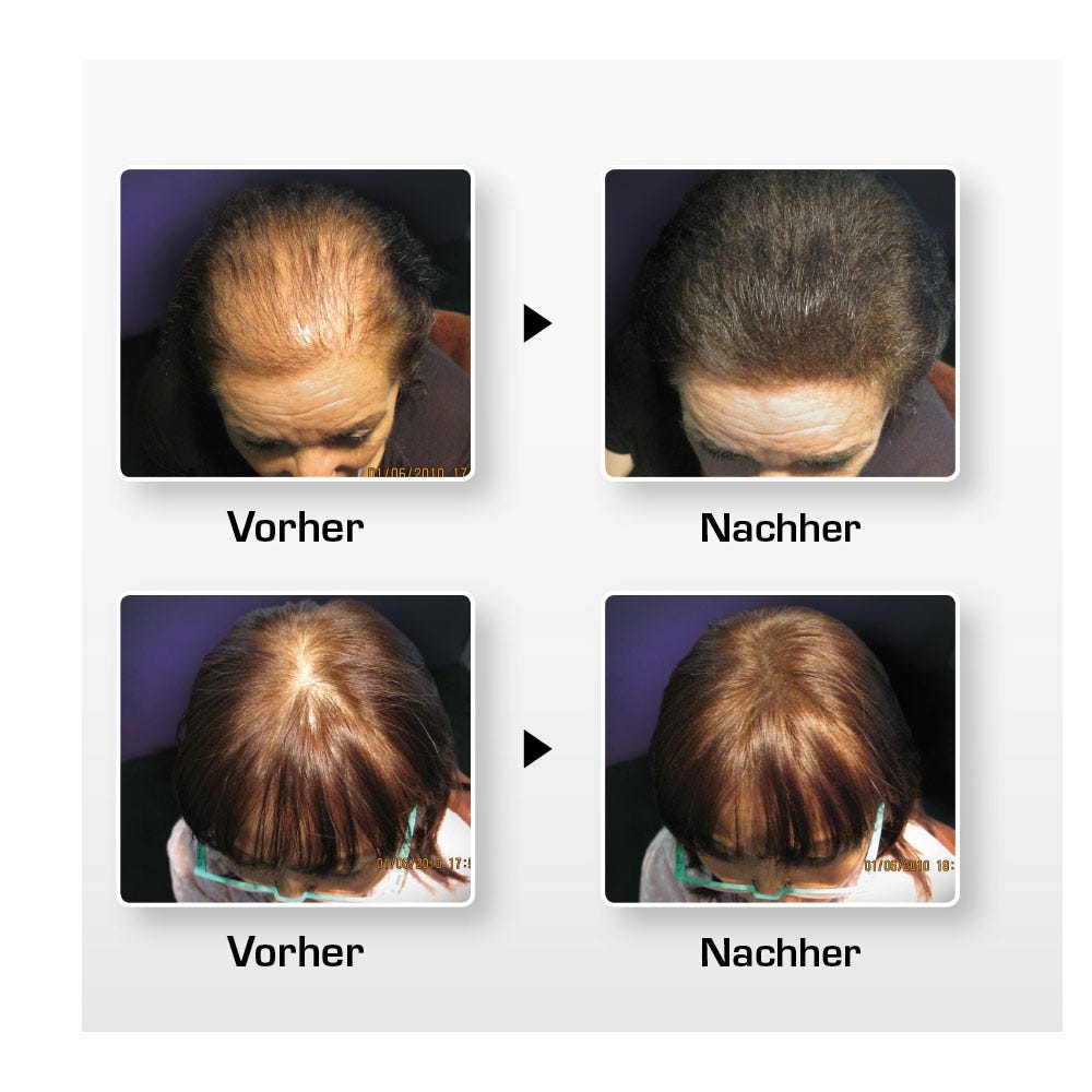 BioThik Haaraufbau-Faser S5 dunkelblond 25 g
