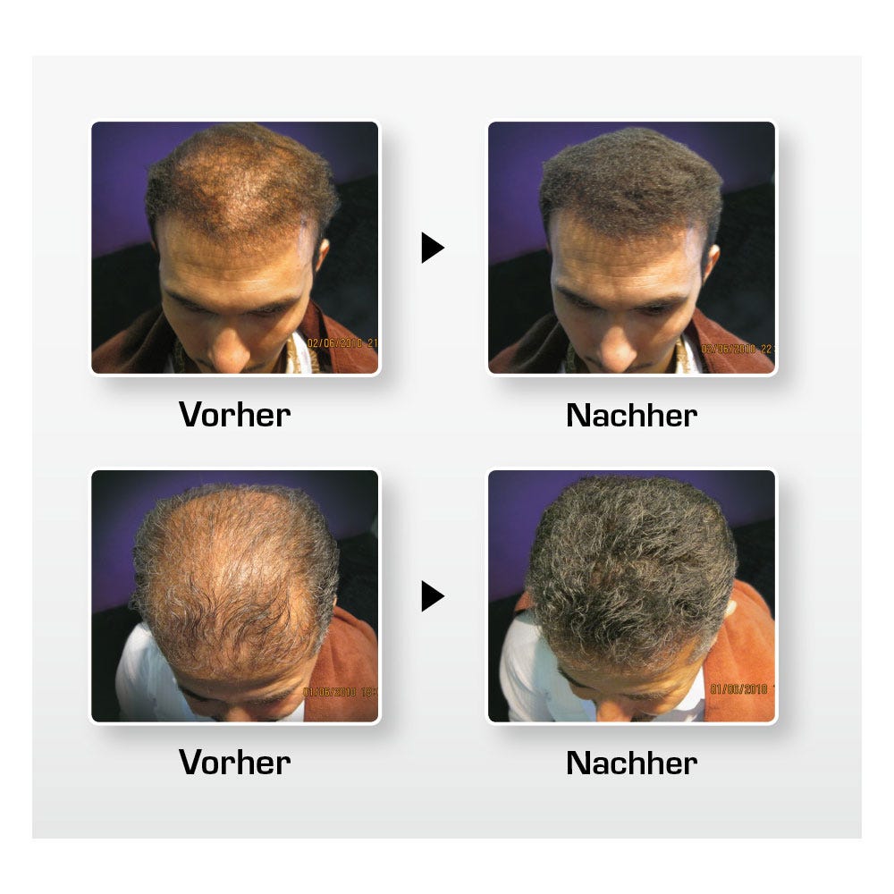 BioThik Haaraufbau-Faser S6 mittelaschblond 25 g