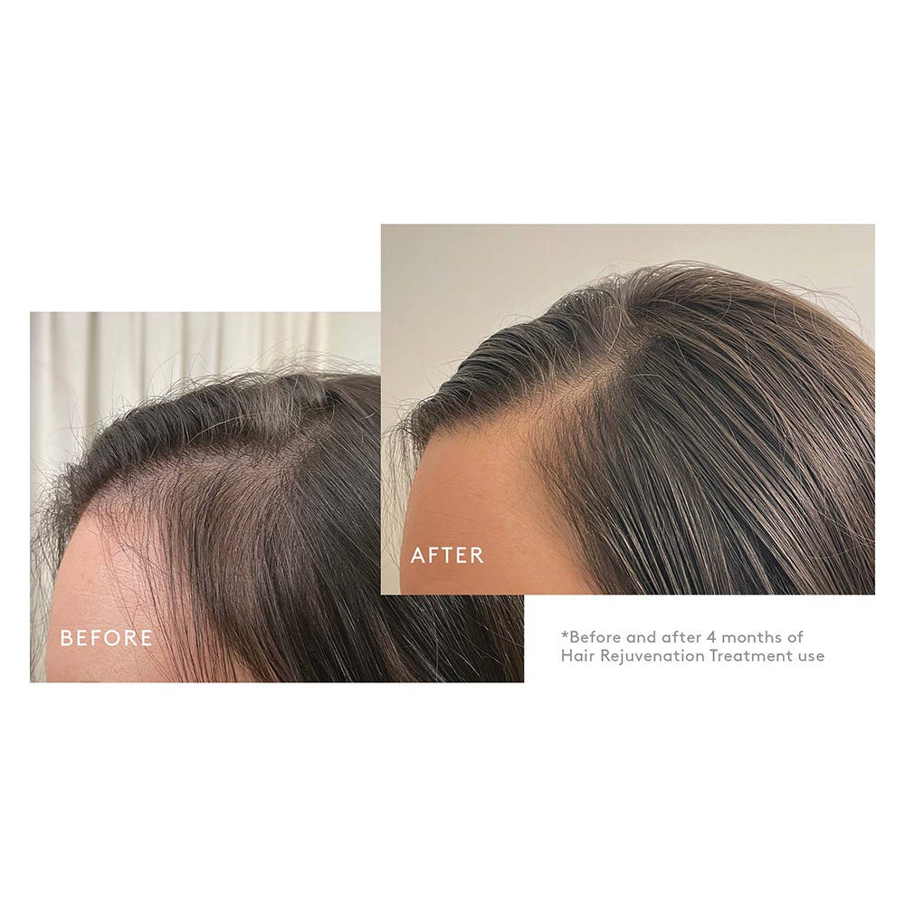 Virtue Flourish Phyto-Follicle Nutrient Kit