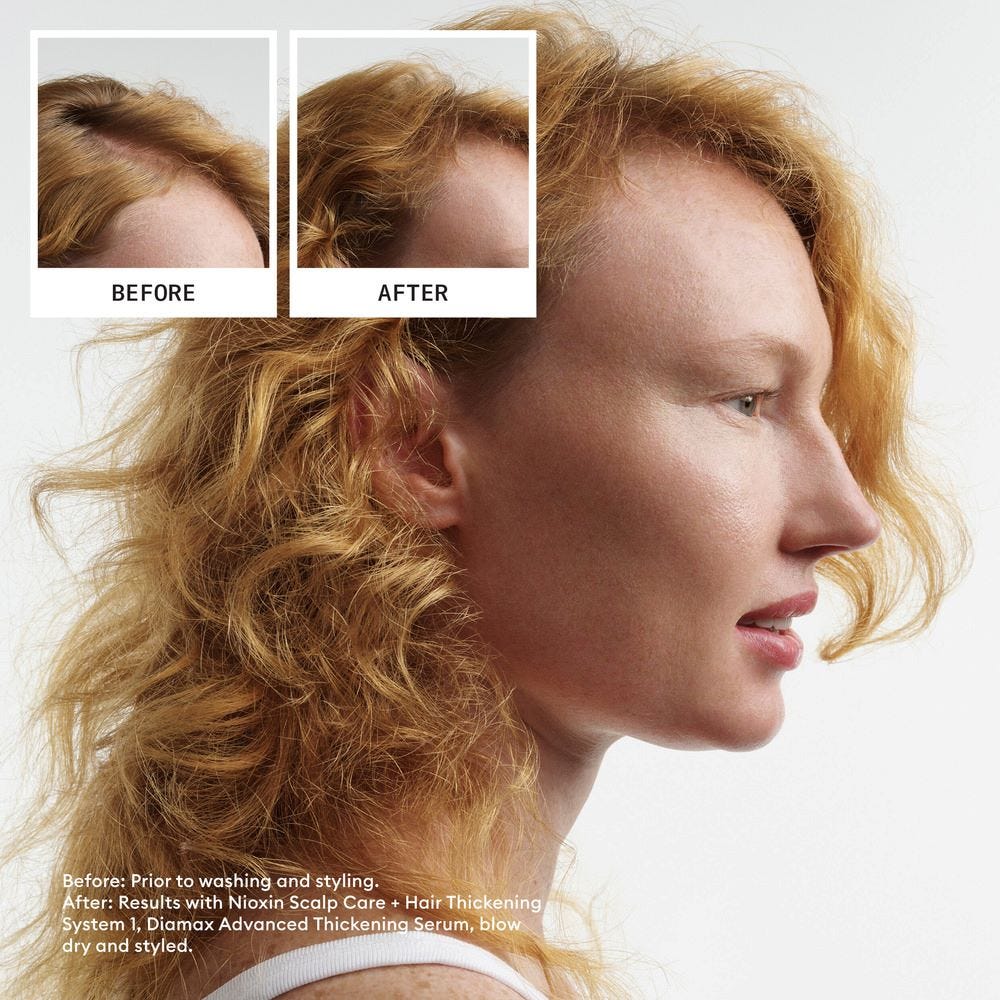 Nioxin Scalp + Hair System 1 Treatment 100 ml