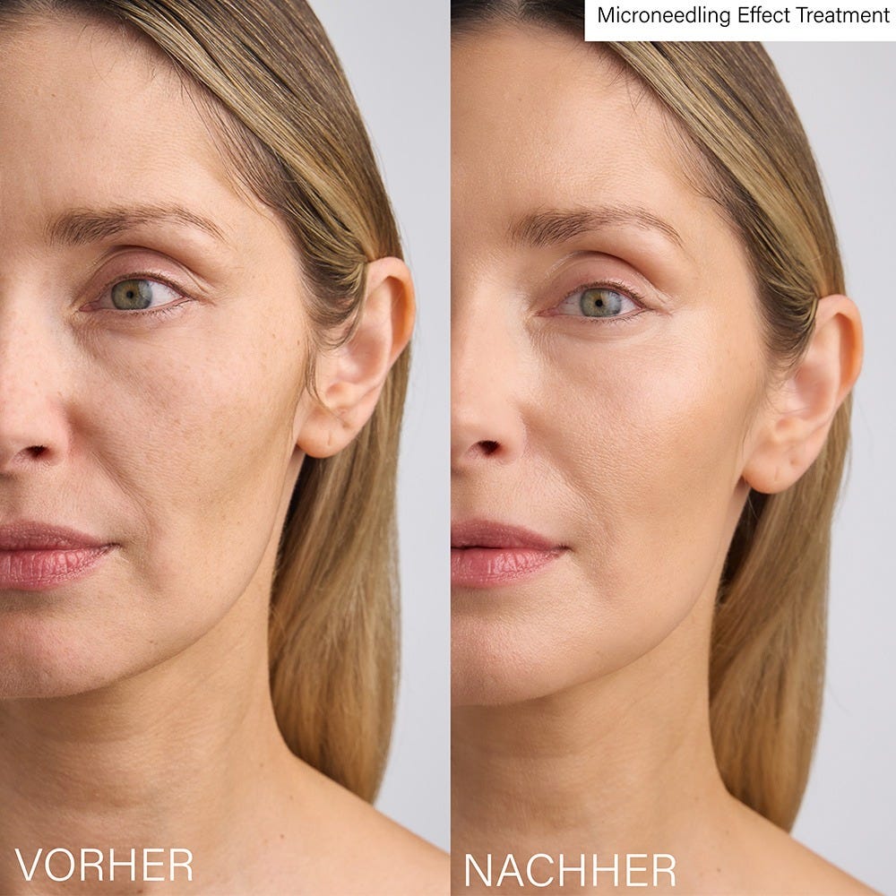 Rosental Organics Microneedling Effect Treatment 30 ml