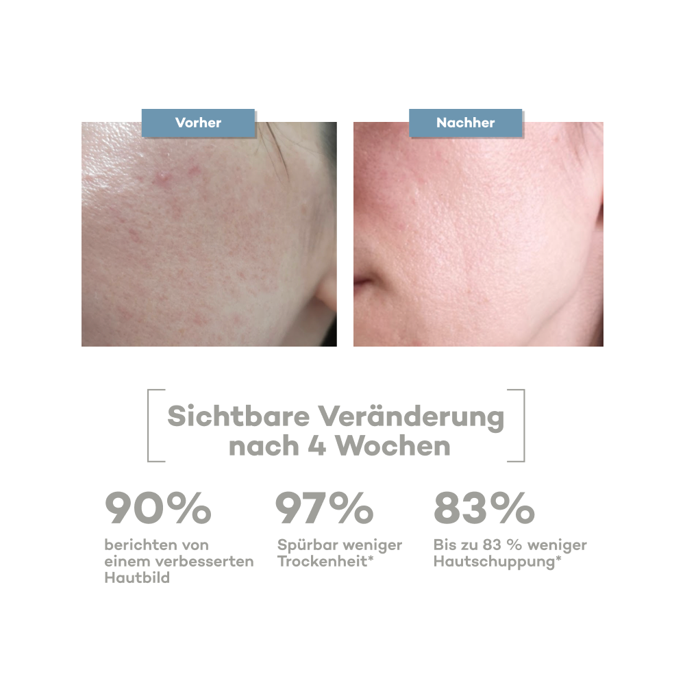12143469-Menge-50 ml