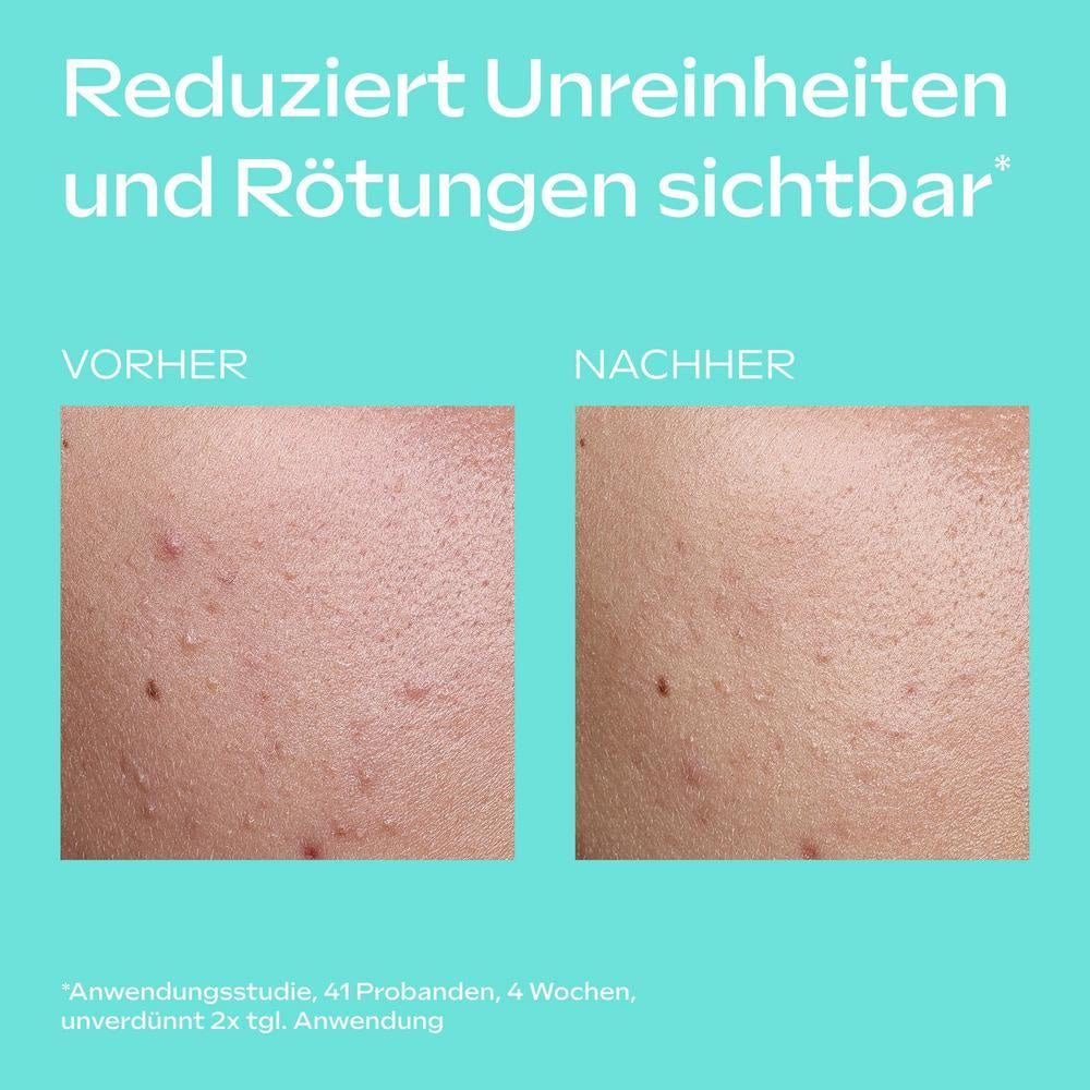Weleda Clear & Pure Skin Serum Booster Drops 30 ml