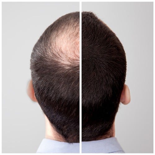 Volume Hair Fix 100 ml